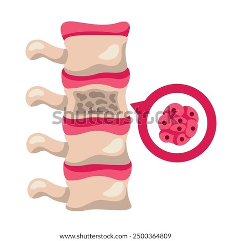 multiple myeloma awareness month isolated