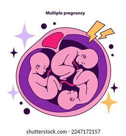 Multiple pregnancy as a disadvantage of In vitro fertilization. Modern technology for infertility treatment. Artificial pregnancy procedure cons. Flat vector illustration