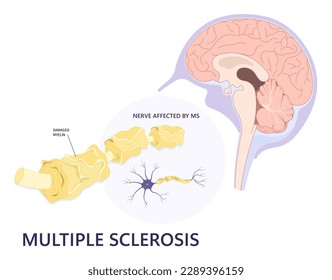 Sistema sensorial del cerebro y las neuronas el concepto en medicina