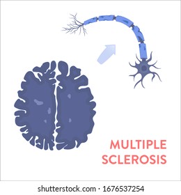 Multiple Sclerosis Awareness Illustration Of An MRI Scan Of The Brain Affected By MS. Demyelination Of Neuron Shealth. Central Nervous System Disease. Medical Concept. 