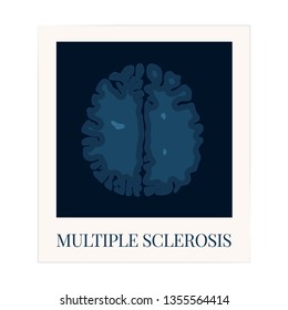 Multiple Sclerosis Awareness Poster With An MRI Scan Of The Brain Affected By MS. Central Nervous System Disease. Medical Concept. Vector Illustration.