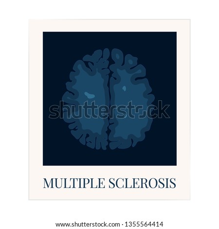 Multiple sclerosis awareness poster with an MRI scan of the brain affected by MS. Central nervous system disease. Medical concept. Vector illustration.