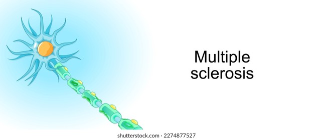 Multiple sclerosis. demyelinating disease. autoimmune disease. Vector illustration for poster or banner about World Multiple Sclerosis Day. 