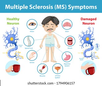 Multiple sclerosis (MS) symptoms information infographic illustration