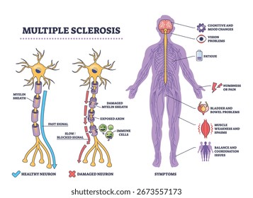 Visão geral da esclerose múltipla mostrando danos aos neurônios, células imunitárias e principais sintomas em um diagrama claro. Diagrama de estrutura de tópicos