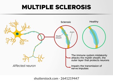 Multiple Sclerosis: vector illustration of information about multiple sclerosis with white background