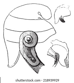 Mumps or epidemic parotitis, vintage engraved illustration. Dictionary of words and things - Larive and Fleury - 1895.