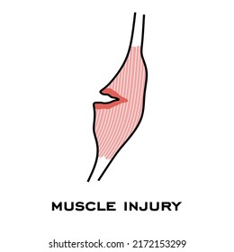 Muscle Injury Icon. Muscle Pain Sign. Pulled Hamstring Isolated On White Background. Hamstring Strain Symbol. Pulled A Muscle Vector Illustration