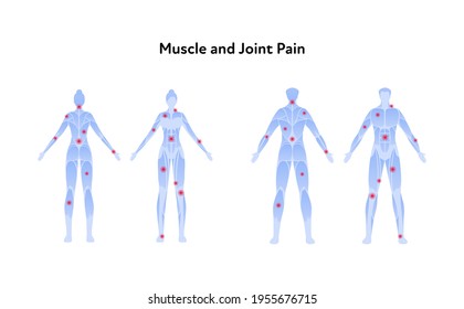 Infografía de dolor muscular y articular. Conjunto de ilustración plana vectorial. Hombre y mujer parados en una silueta sin piel azul con un punto de dolor rojo. Vista frontal y posterior. Elemento de diseño para la atención médica.