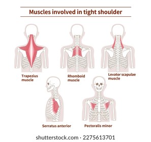 Muscle sets in the back that cause tight shoulder