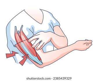 Muscle weakness with weak and fatigue muscular system outline concept. Medical issue with physical disorder and arm cramps, exhaustion, pain or dystrophy vector illustration. Body atrophy problem.