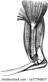 Los músculos del brazo incluyen músculo deltoide, músculo biceps y músculo triceps. Un hueso se fractura cerca del codo, el dibujo vintage o la ilustración grabadora.