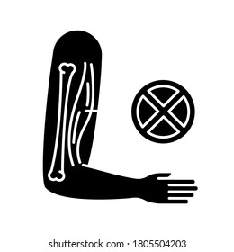 Muscular Dystrophy Black Glyph Icon. Chronic Genetic Disorder. Tissue Damage In Human Arm. Patient With Medical Diagnosis. Silhouette Symbol On White Space. Vector Isolated Illustration