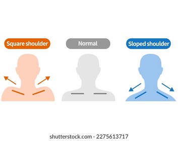 Muscular structure of the square shoulder and sloped shoulder