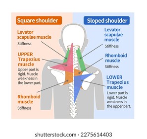 Muscular structure of the square shoulder and sloped shoulder