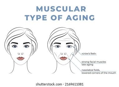 Muscular type of aging on the face. The face of a woman in her youth and old age.