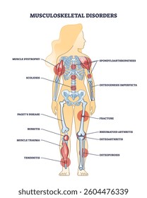 Musculoskeletal disorders diagram highlights key conditions like arthritis, osteoporosis, and scoliosis. Outline diagram.