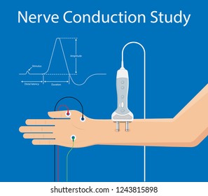 Myasthenia gravis (MG) disease treatment diagnosis test bell palsy exam nerve stimulation weakness problem muscular motor cubital guillain barre peripheral neuropathy neuron polymyositis injury