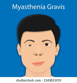 Myasthenia gravis (MG) disease treatment diagnosis test bell palsy exam nerve stimulation weakness problem muscular motor cubital guillain barre peripheral neuropathy neuron polymyositis injury