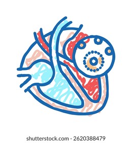 myocarditis disease doodle icon sketch vector. myocarditis disease sign. isolated symbol illustration