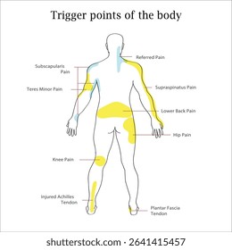 Myofascial trigger points, are described as hyperirritable spots in the fascia surrounding skeletal muscle. Palpable nodules in taut bands of muscle fibers. back view of a man. Myofascial pain syndrom