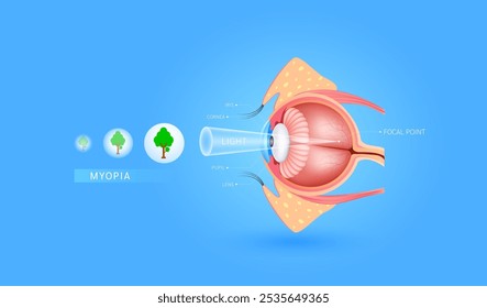 Myopia blurred vision. Seeing images up close is clear but distant objects are not clear or blurry. Human eye visual system anatomy. Medical science diagnosis. Vector EPS10.