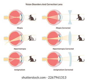 Myopia, hyperopia and astigmatism. Common vision disorders and its correction. Corrected eyesight by plus positive and minus negative lens. Flat vector illustration