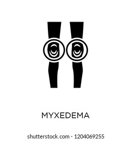 Myxedema icon. Myxedema symbol design from Diseases collection. Simple element vector illustration on white background.