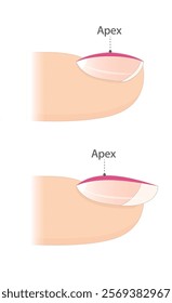 Nail apex. Infographic for nail extension. Manicure. Nail design.