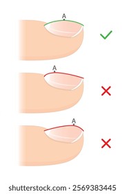 Nail apex. Infographic for nail extension. Manicure. Nail design.