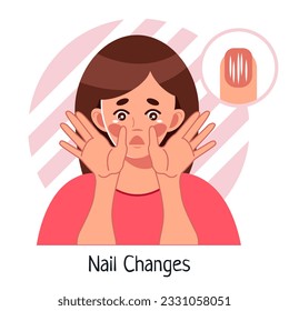 Nail Changes. A frightened woman looks at her nails. Brittle nails, nail pits, depressions. A symptom of anemia, lack of vitamins. Vector medical illustration in cartoon styled