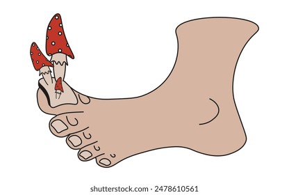 Nail Fungus concept isolated white. Trendy Groovy vector illustration of a foot with Toadstools on the Nail. Flat style Fungal Infection art.