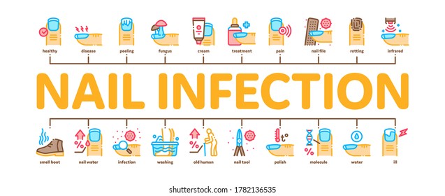 Nail Infection Disease Minimal Infographic Web Banner Vector. Nail Infection And Treatment, Virus And Research, Smell Boot And Feet Wash Illustration