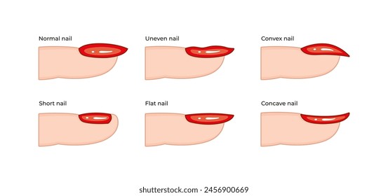 NAIL SHAPES types of nail arches.