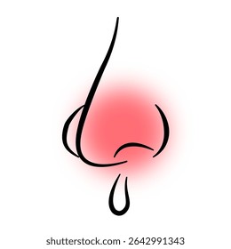 nasal congestion, commonly known as a stuffy or blocked nose, often accompanied by a runny nose.