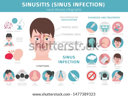 Nasal diseases. Sinusitis, sinus infection diagnosis and treatment medical infographic design. Vector illustration Stock photo © 