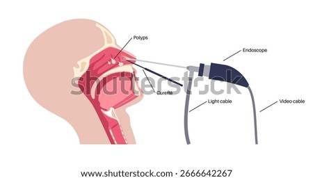 Nasal endoscopy, minimally invasive diagnostic procedure. Rigid endoscope. Exam of the nasal cavity, sinuses, and nasopharynx. Chronic sinusitis, nasal polyps, deviated septum or tumor flat vector