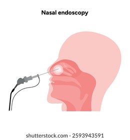 Nasal endoscopy procedure nasal and sinus passages. Thin, flexible tube with camera and light. Medical diagram