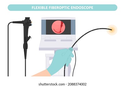 Nasal Endoscopy. Throat back voice box larynx vocal cord pain airway endoscopic sinus surgery ear nose sleep apnea oral airway septal obstructive biopsy tumor Pharynx flexible fibre optic polypectomy