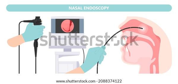 Nasal Endoscopy Throat Back Voice Box Stock Vector (Royalty Free ...