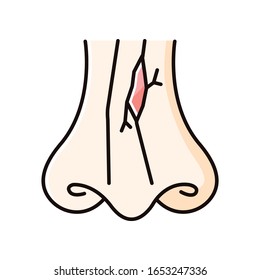 Nasal fracture RGB color icon. Broken nose bone. Crack in nose cartilage. Facial injury, trauma. Accident. Medical condition. Healthcare. Isolated vector illustration