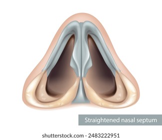 Anatomía del tabique nasal. Nariz, cavidad nasal. Vista inferior