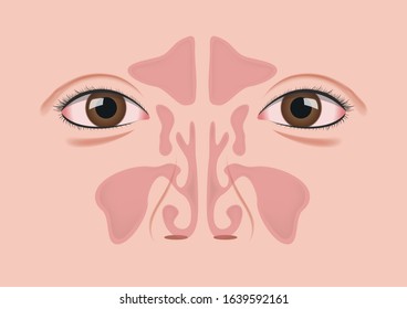 nasal sinus with human face vector 