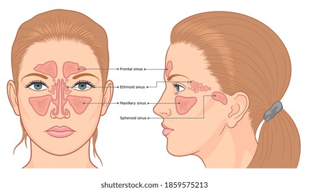 Nasal sinuses anatomy medical vector illustration. 
