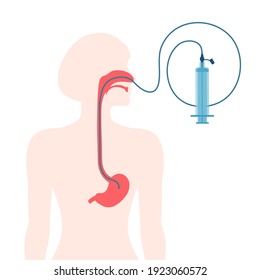 56 Orogastric tube Images, Stock Photos & Vectors | Shutterstock