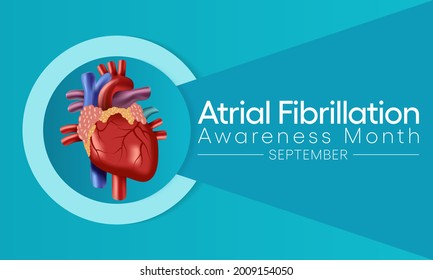 National Atrial Fibrillation (AFIB) Awareness Month Is Observed Every Year In September, It Is A Heart Condition That Causes An Irregular And Often Abnormally Fast Heart Rate. Vector Illustration