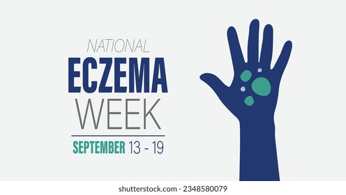 National Eczema Week. September 13 - 19, 2023 vector awareness campaign banner.
