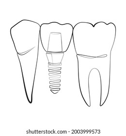 Natural and artificial teeth line drawing on white isolated background