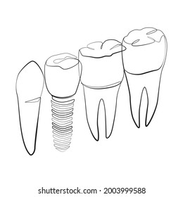 Natural and artificial teeth line drawing on white isolated background