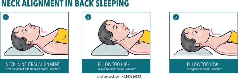 Neck Alignment In Back Sleeping